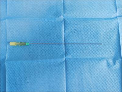 A novel, simple near-infrared thoracoscopic technique by a particular route for locating lung nodules